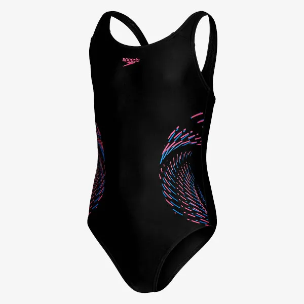 Speedo Plastisol Placement 